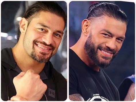 did roman reigns get a nose job